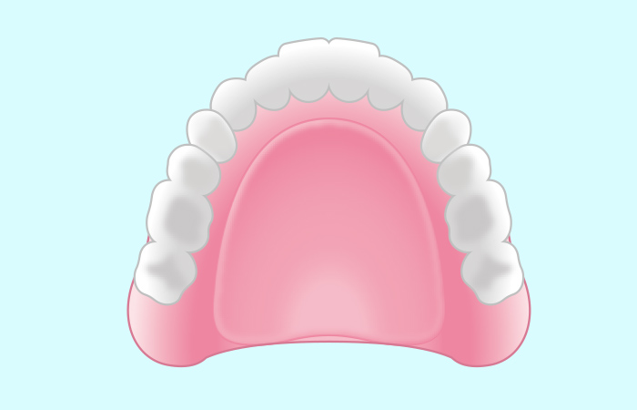 レジン床義歯（保険適用の総入れ歯）